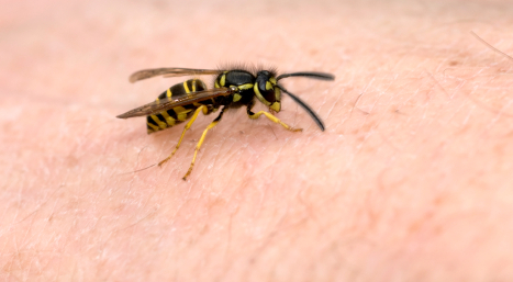 Bite